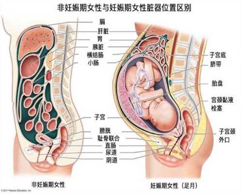 广州金贝供卵 骗局-代孕代怀孕包成功_试管婴儿男性要注意什么