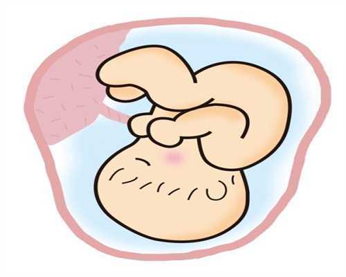 广州专业的合法代孕-比较好的代孕机构_泰国试管攻略之多囊卵巢患者如何圆生