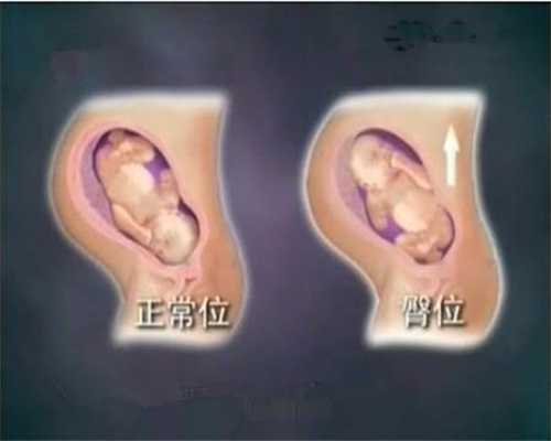 广州专业的合法代孕-那个代孕中介最有_单身男性赴美做试管婴儿，需要用到什