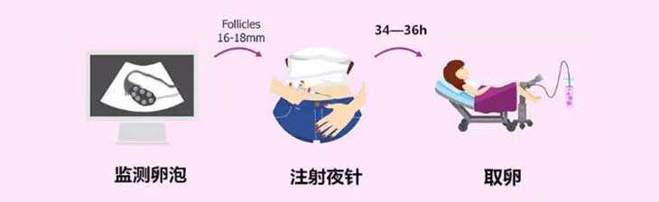 代孕妈一般什么价位-广州有代孕的没有_俄罗斯试管婴儿微刺激方案流程分享
