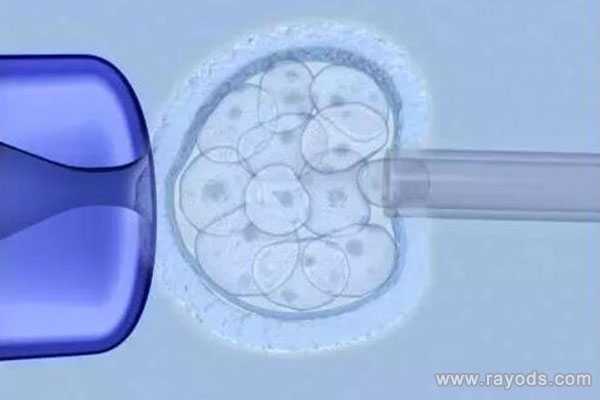 广州代孕生个孩子-三代试管代孕可以选性别吗_泰国试管婴儿专家分析：养囊的